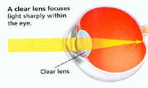 a clear lens allow light rays to focus
