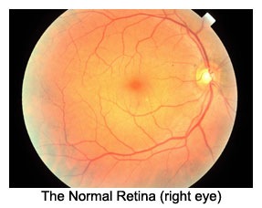 A normal healthy retina